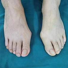 17 17